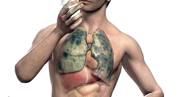 دراسة جديدة تربط بين التدخين وسرطان الرئة